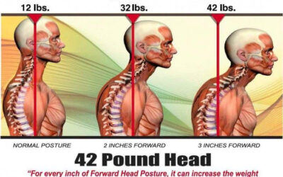 Physical Therapy for Headaches